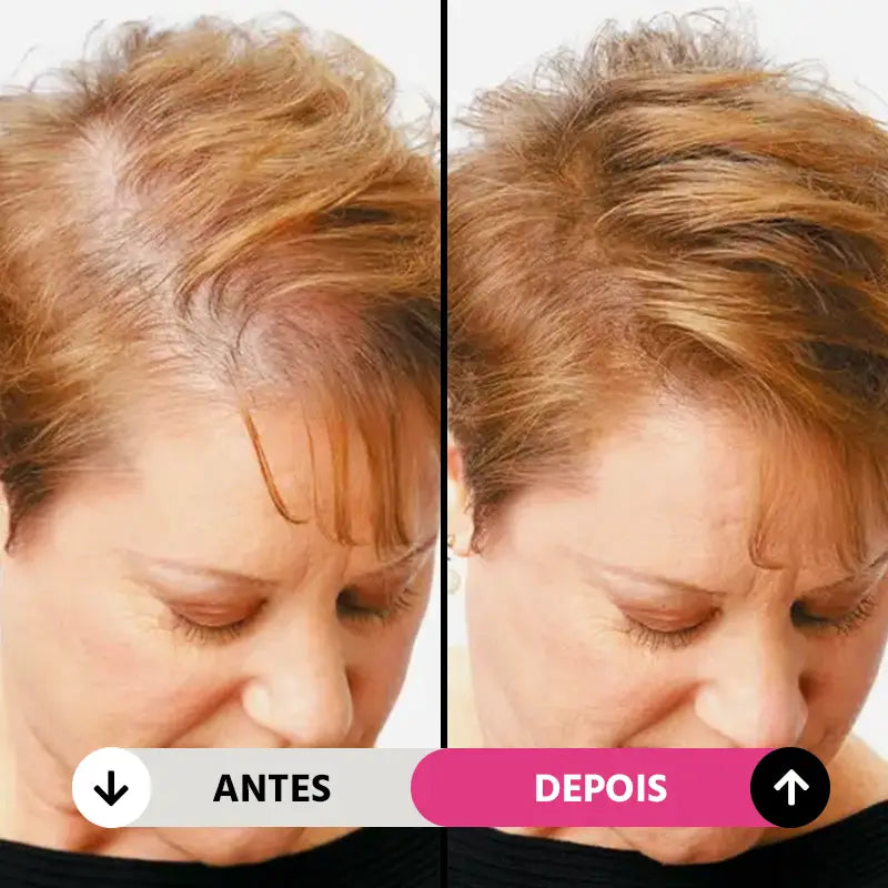 Preenchimento de Maquiagem Capilar para Esconder Cabelos Brancos e Ralos À Prova D'Agua Natural Unissex FillHair